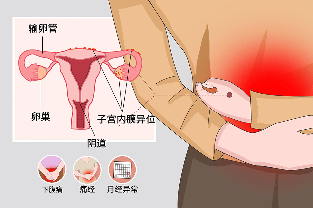 子宫卵巢图片位置图图片