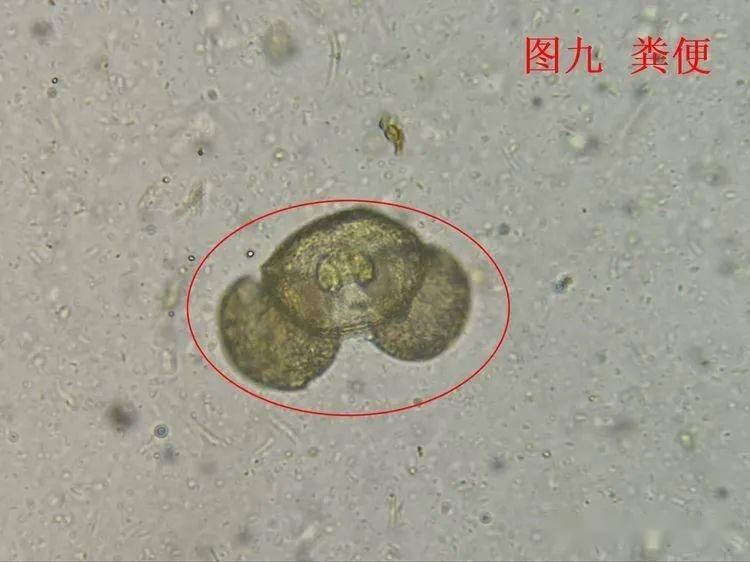 看图识细胞(第99期)_形态