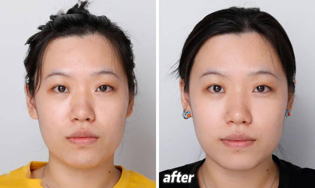 仙女|女星不化妆时，为何还能自带滤镜？