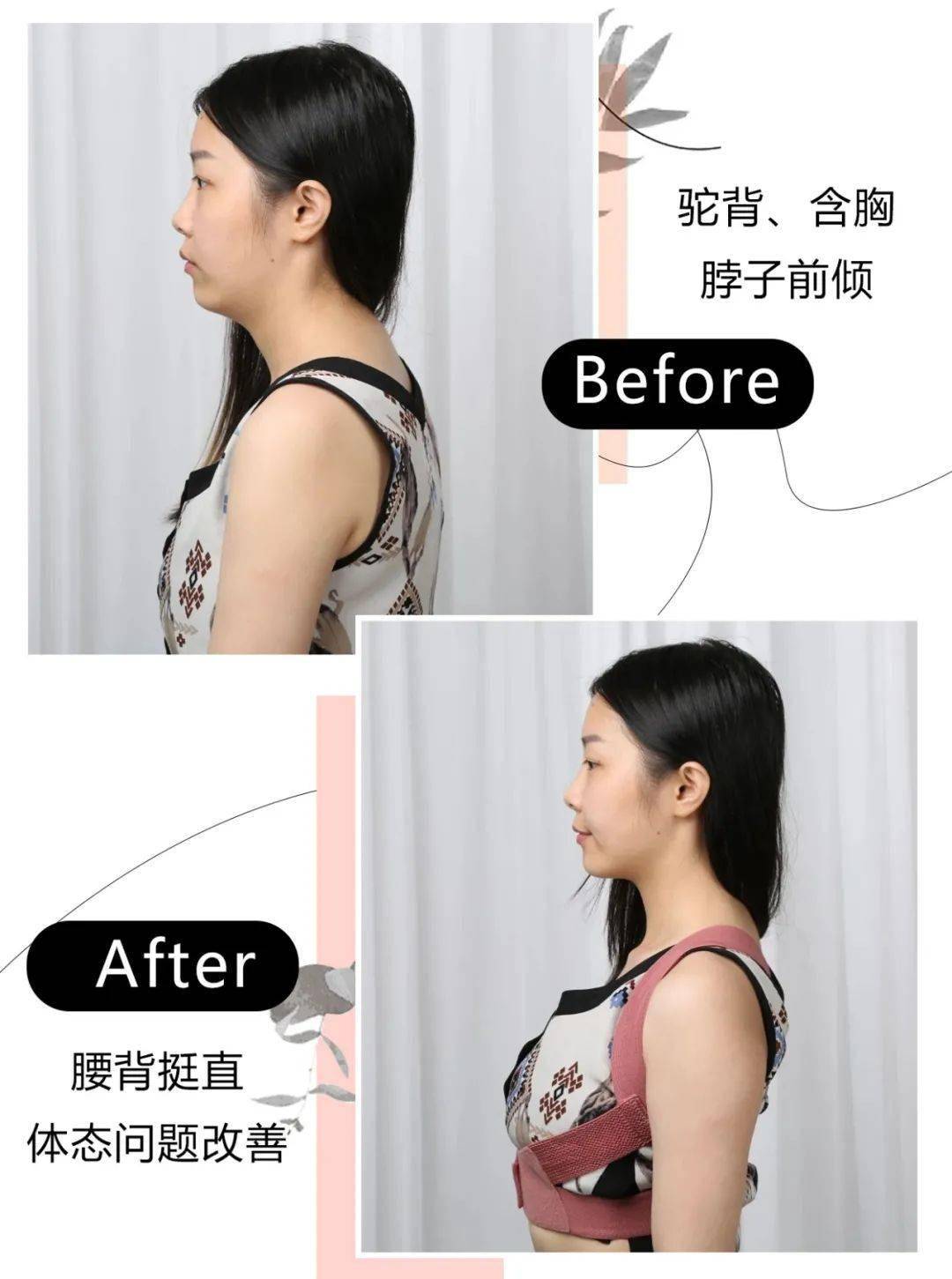 驼背和不驼背的女生差距居然这么大说出来你肯定不信