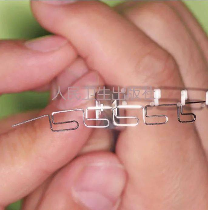 【高清图解】基本meaw弓丝的弯制和应用