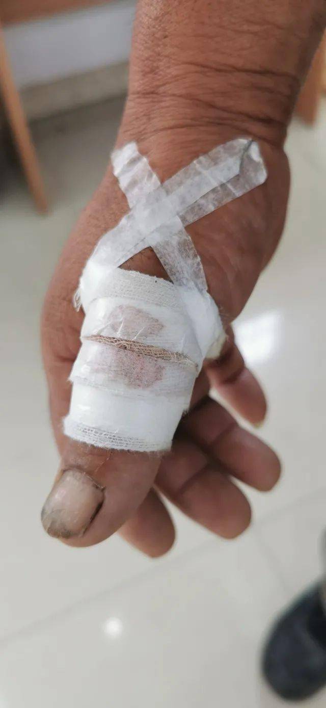 【轻伤不下火线】53岁老党员赤膊跳进排水井