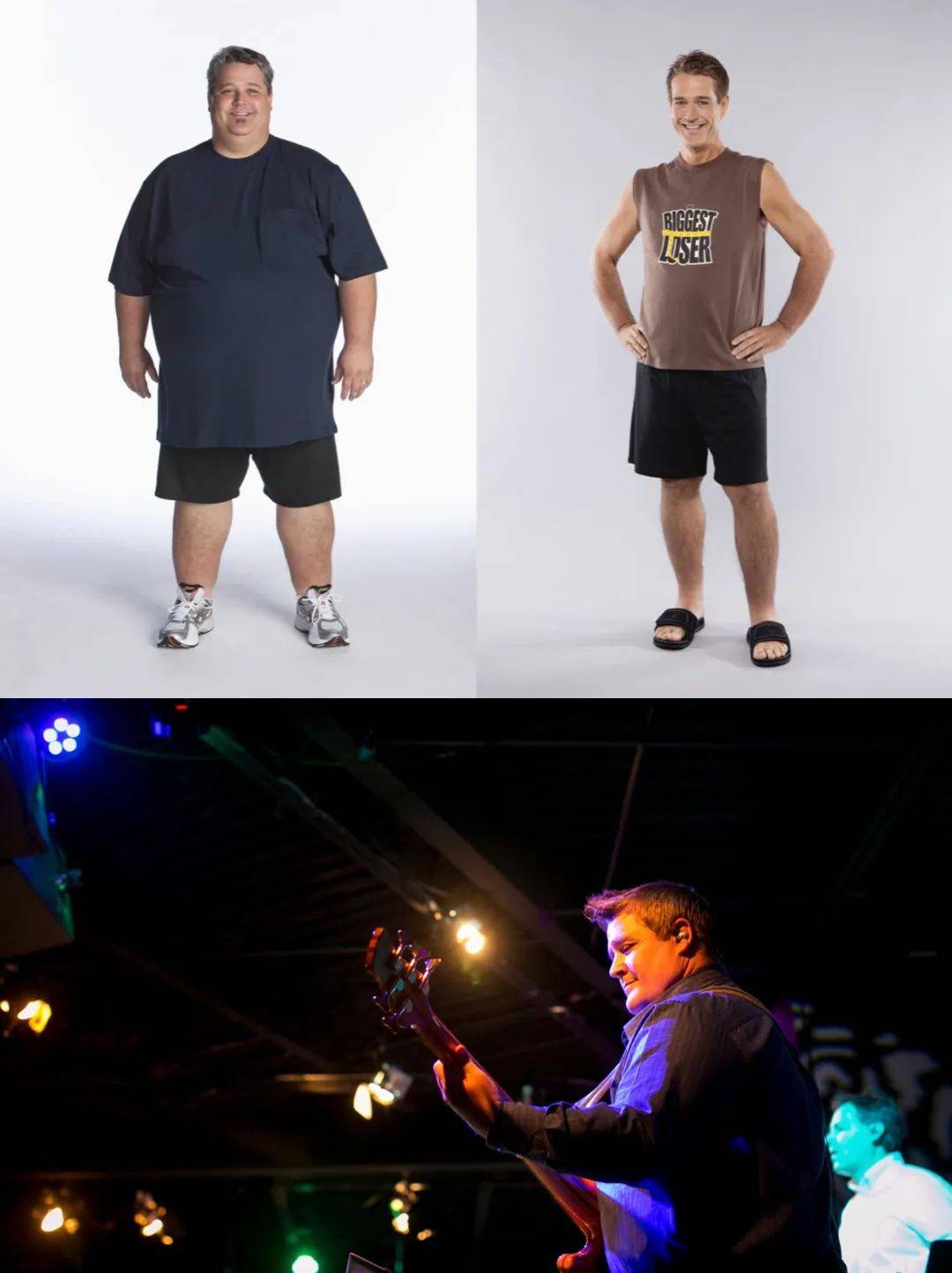 UpToDate|为了减肥切掉胃，不是偷懒，是救命