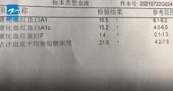 视力|浙江一15岁男孩右眼接近失明，只因为常喝…很多人都喜欢！