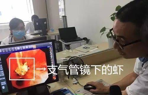 假牙|消失的假牙钩在气管上，杭州大伯“心肺都要咳出来”！这些动作不要再做了！