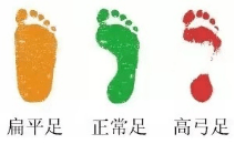 身体状况|全民健身日：医学专家教你科学跑步，不同足弓选择跑鞋有讲究