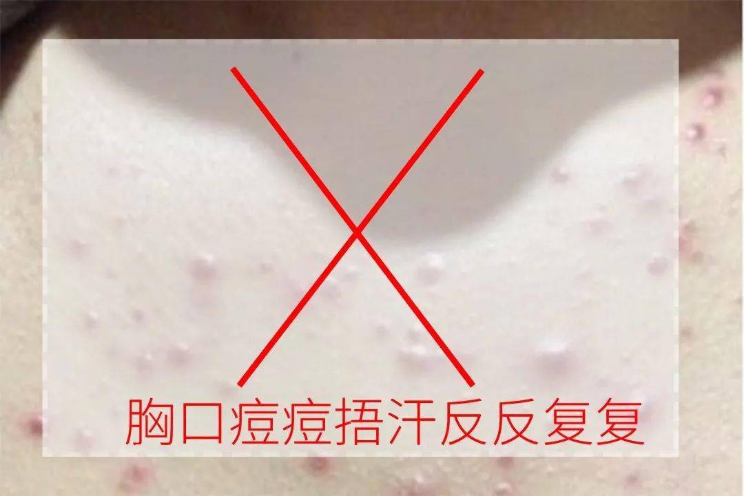 全网|明星“伪真空”上阵，全网居然都在学？！裸感无痕，我已经沦陷……