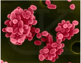 病因|江苏阿婆反复高烧一个月,排除新冠仍不明病因,最后医生发现源头在动物身上