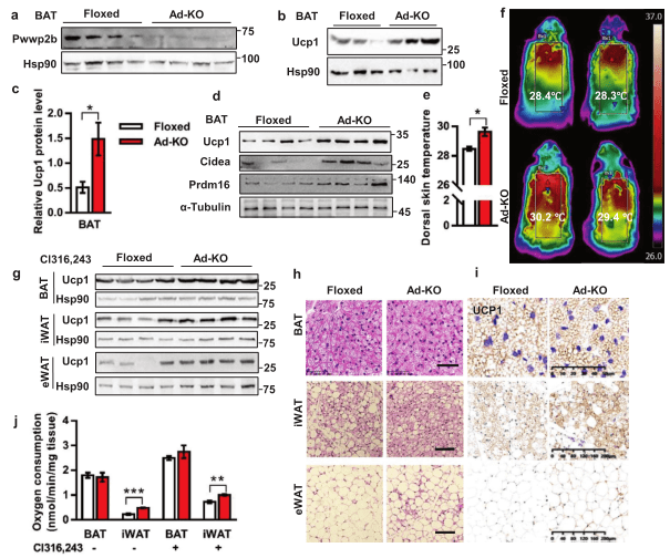 项目文章 Adv Sci (IF=15.804)|可爱小胖的福音！复旦大学潘东宁团队发现调控脂肪产热重要蛋白_Ucp