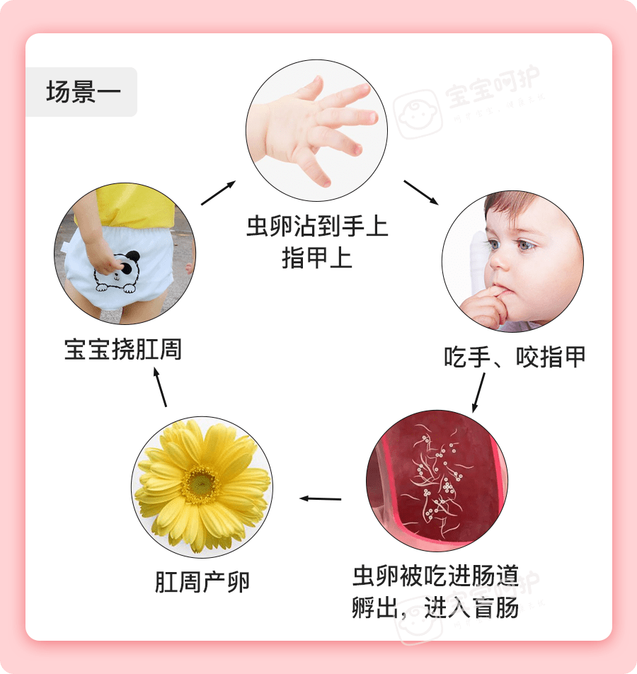 儿童蛲虫图片如何抓虫图片