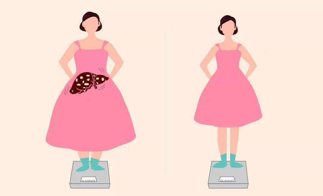 他汀|辟个谣,瘦子也会高血脂!