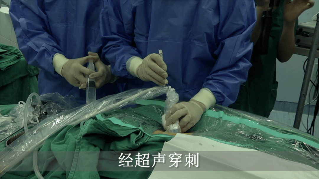 引进最新的进口气体测压尿动力系统,培养一批技术过硬的尿动力检查