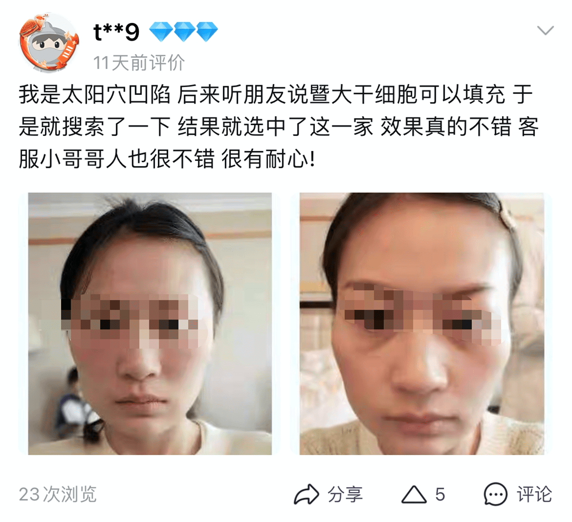 都可|有商家假借暨南大学名号网售干细胞因子，胸部、私处都可填充