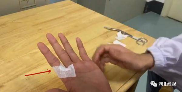 伤口|痛心！3岁女童竟因此被截掉手指