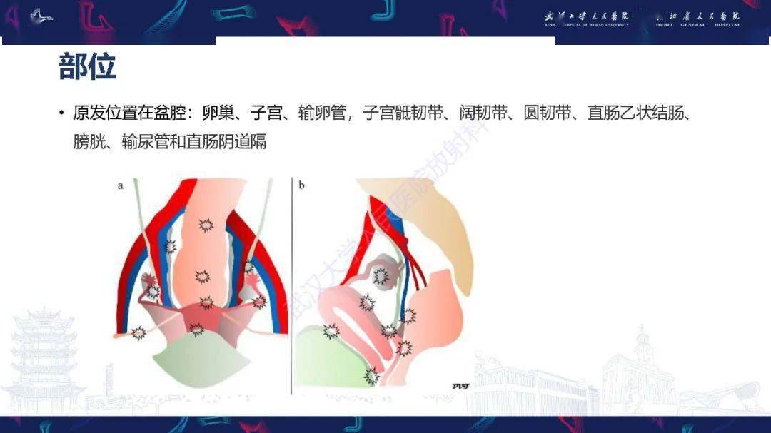 頭頸系統超全影像文章彙總全網最全頭顱影像解剖學,不容錯過(更新版)