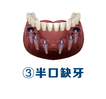 北京口腔医院挂专科号CT加急-北京口腔医院现场挂号可以挂多久的 