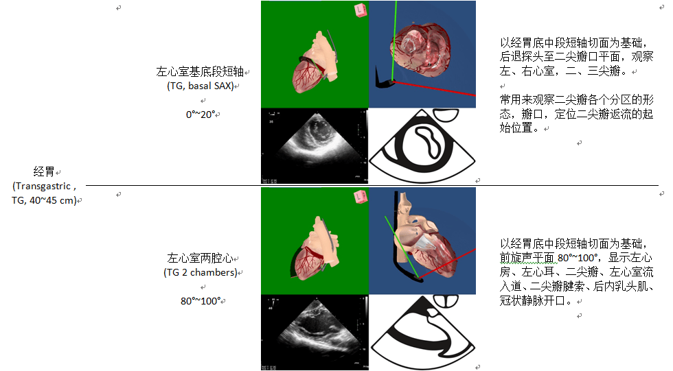 ue ,食管上段;me,食管中段;tg,經胃;lax,長軸;sax,短軸;asc,升主動脈