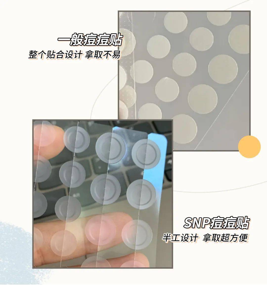 颜蜜|随便乱挤痘痘的女生，都是这个下场...