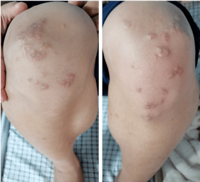 可能是急性心梗!