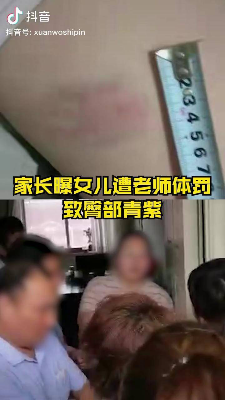 全班学生遭体罚被打学生家长发声棍子打成三截屁股肿得不能碰