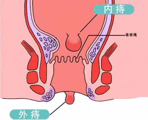 d2f32a8c37b64f0a9d116121e1d560c1.gif