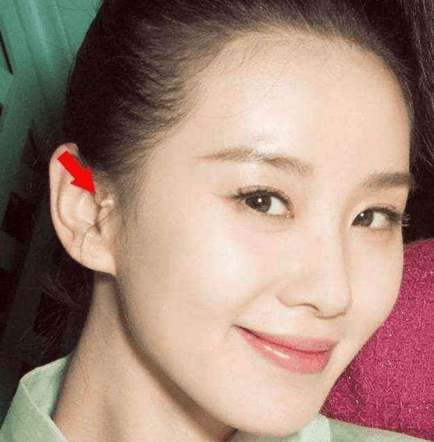 国民女演员刘诗诗也是长有附耳的人,作为一个女明星,若是附耳大小跟我