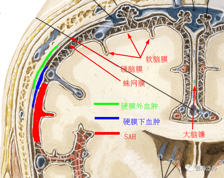 蛛网膜解剖结构图解图片