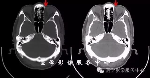 ct眼环的结构图图片