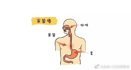 恶性肿瘤|饮食冷热硬 易患食管癌