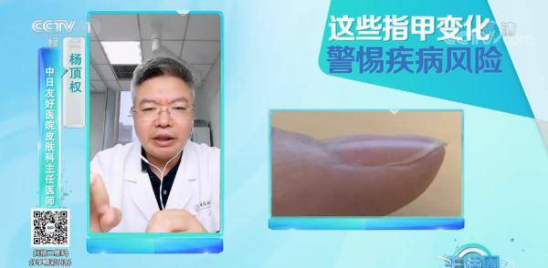 变化|请低头：长这几种指甲的人注意了