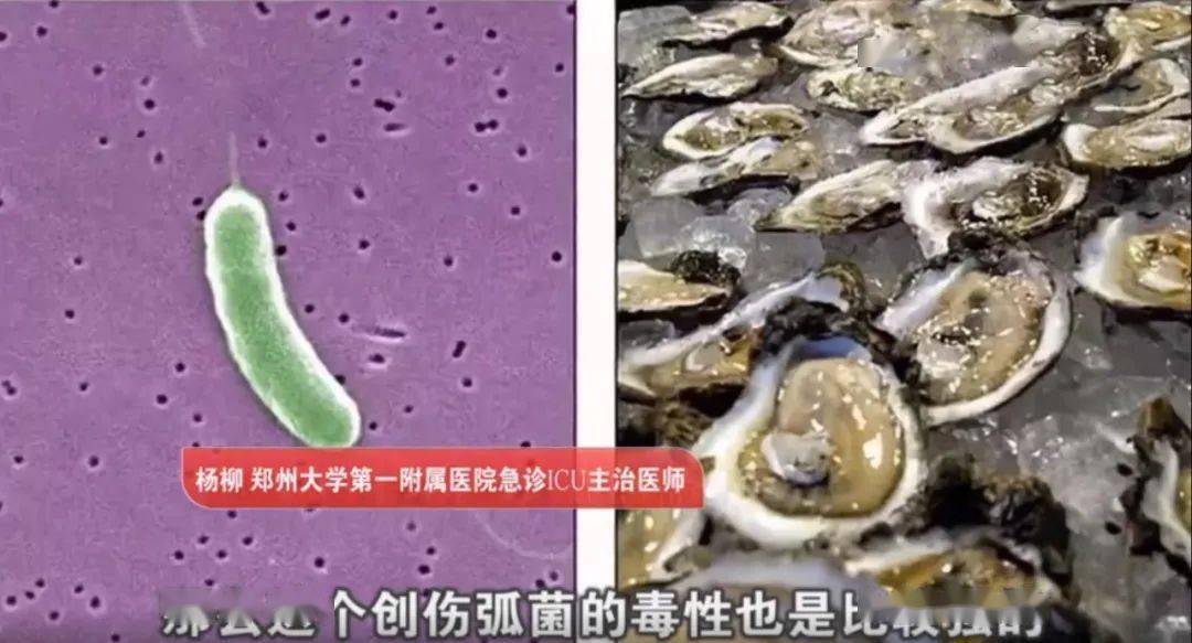 海洋创伤弧菌感染图片
