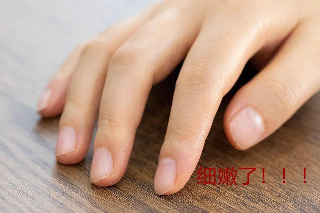 中国|观方好物 | 北京协和医院：我们从未出过维E乳