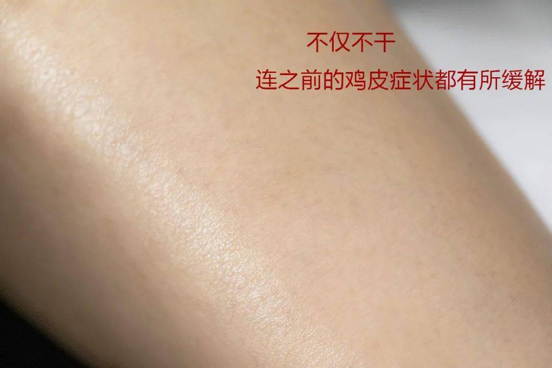 中国|观方好物 | 北京协和医院：我们从未出过维E乳