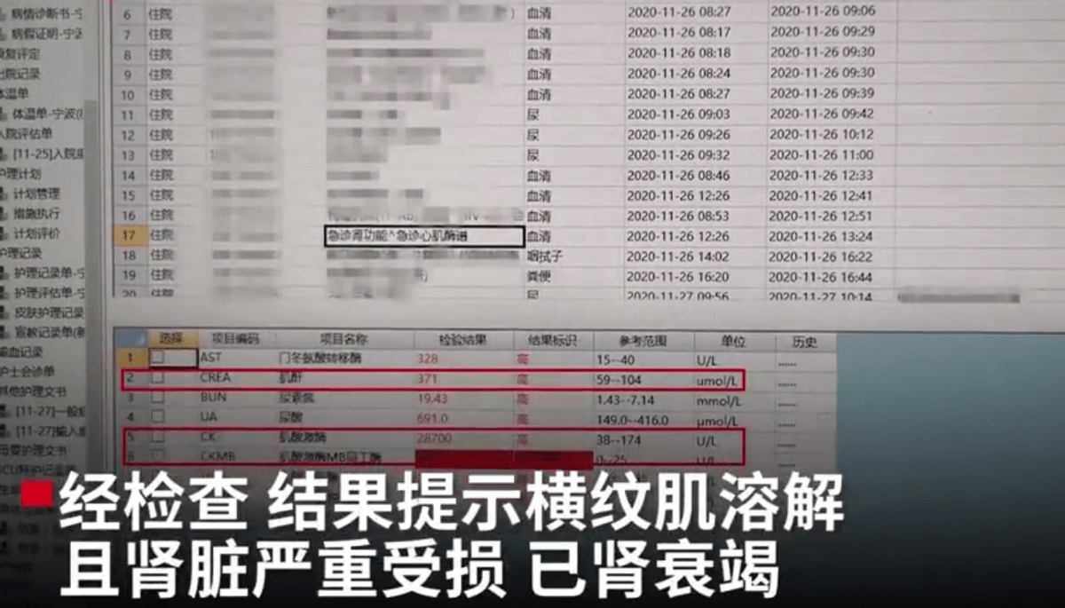 酸酸甜甜就是我发行日期 30f6bf8870de40ecb153ad93b8ba4af0.png