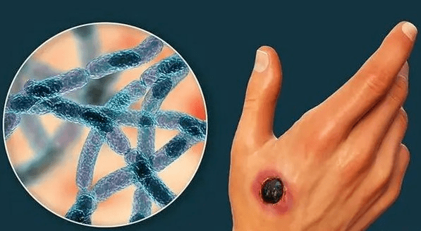 动植物检疫警惕炭疽这些知识需要您了解