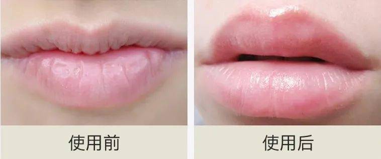 急救|唇纹又深又显老!急救起皮干裂,嘴巴像融化了一样,又软又糯贼滑溜!