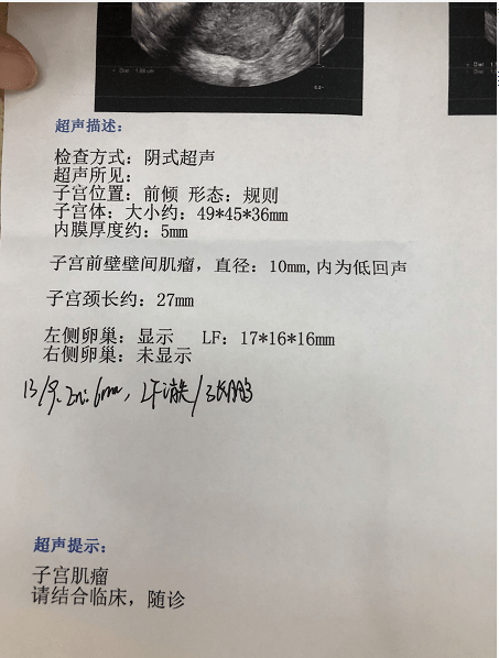 这两样儿关乎怀孕成败