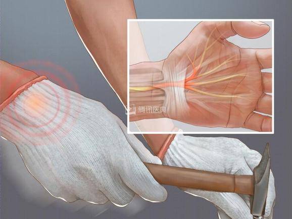 时间|加班加出了一身病？这5个方法拯救你