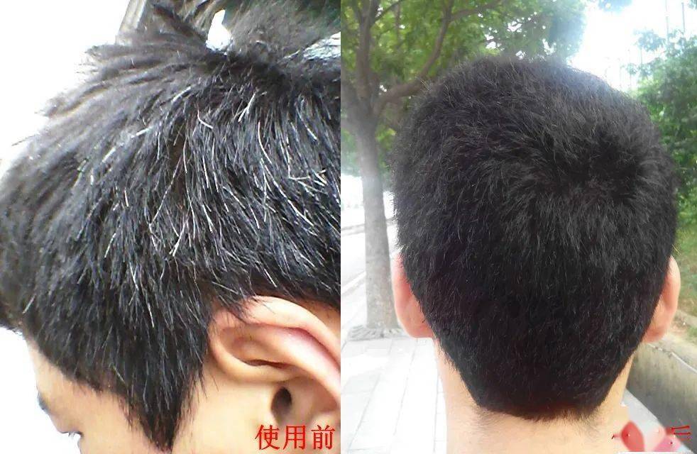 汪女士|白发越长越多？原来是这里出了毛病！坚持一招，养一头乌黑墨发！