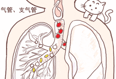 急性上呼吸道感染是什么症状 adca4f77f7a24030bf51826cdd9e7271.gif