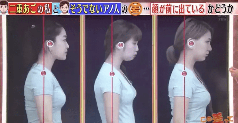 双下巴也太坑人了吧_下颌