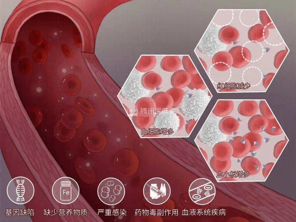 科普|血液病患者如何预防感染