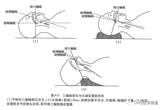 我们还会检查甲颏距离:是指头在伸展位时,测量自甲状软骨切迹至下颏