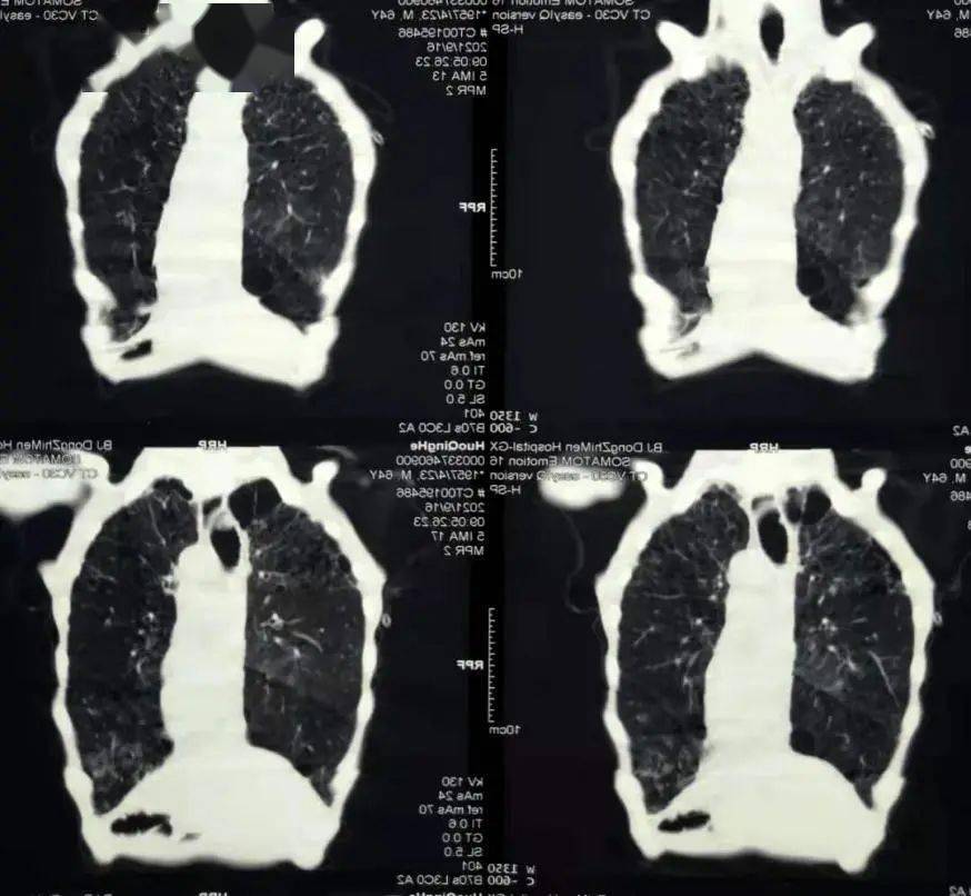 合并|规培医师视角下的多学科协作困难鼻胃管置入