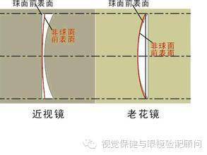 非球面镜片和球面镜片区别价格 8788a70259ba44278404799e03963a0b.jpeg