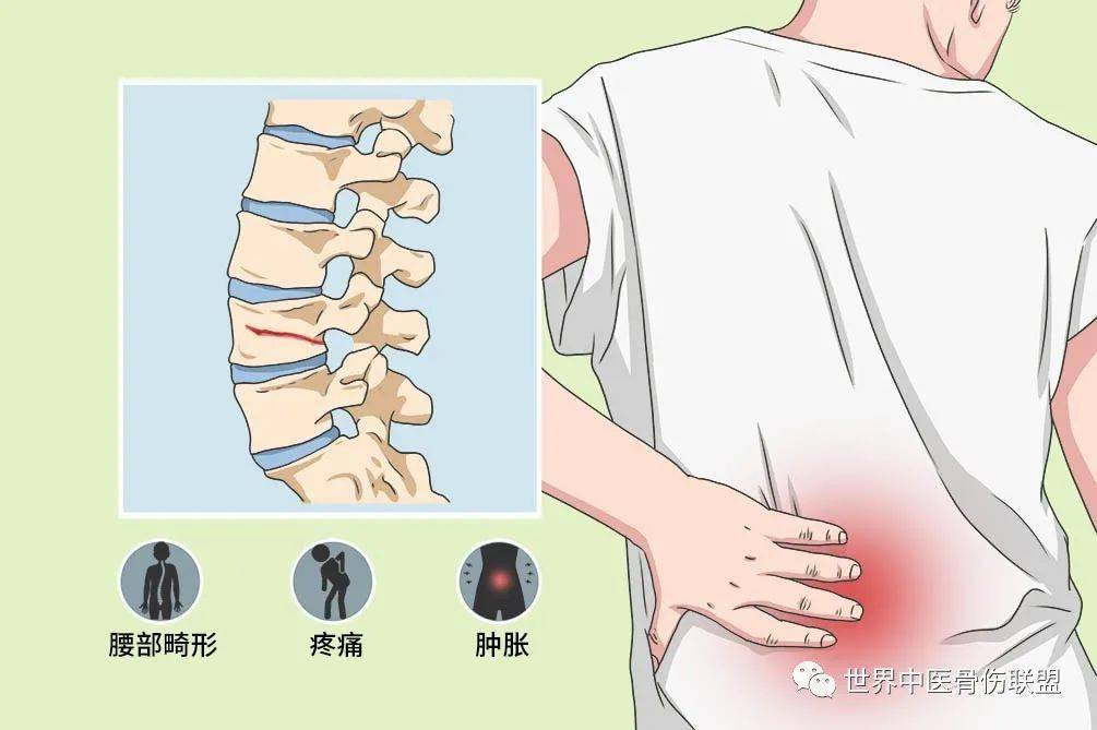 有骨質疏鬆症的人,高空作業的工人,有腰椎骨腫瘤,結核的患者症狀腰椎