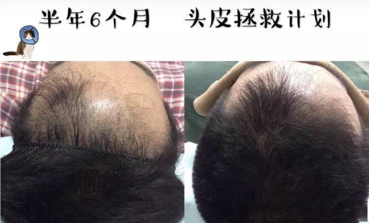 发型为了拯救发际线，日本人可是绞尽脑汁！