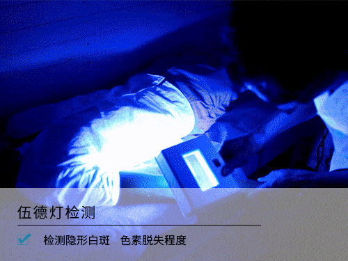 检测|定了！2021国家重点实验室白癜风全省招募正式启动，携沪·辽专家联合会诊