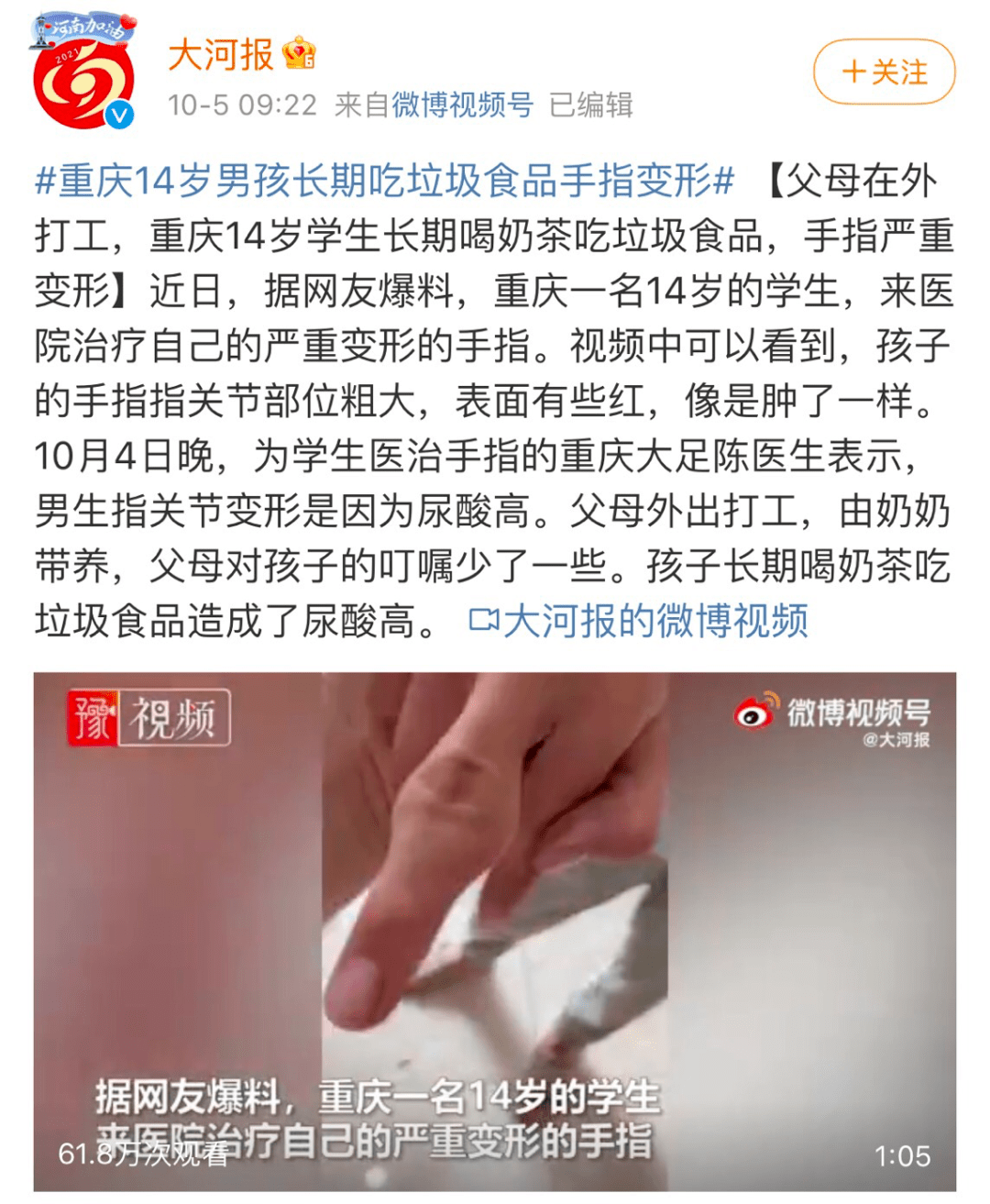 新闻报道了一个重庆14岁男孩,因为长期吃垃圾食品手指已经严重变形