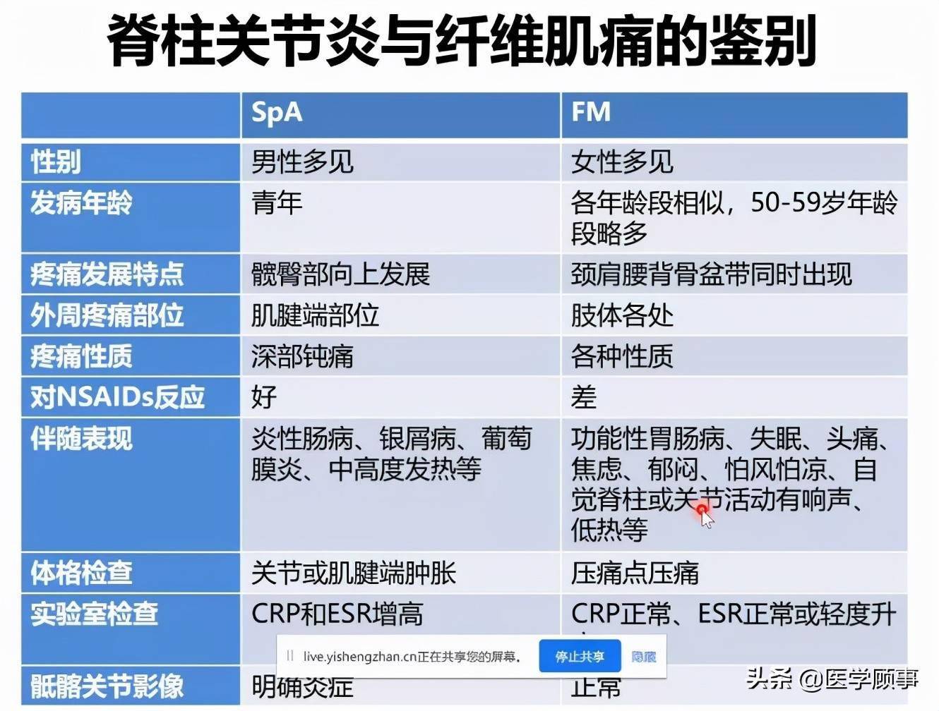 纤维肌痛患者如何才能不漏诊误诊